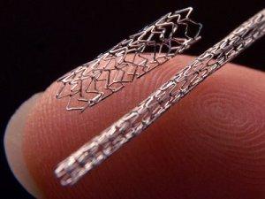 stent-cardiaco